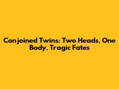 Conjoined Twins: Two Heads, One Body, Tragic Fates