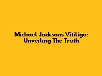 Michael Jackson's Vitiligo: Unveiling The Truth