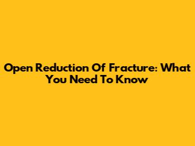 Open Reduction Of Fracture: What You Need To Know