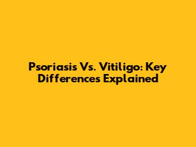 Psoriasis Vs. Vitiligo: Key Differences Explained