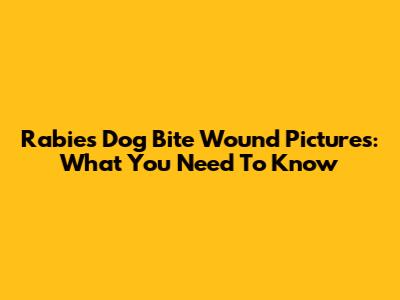 Rabies Dog Bite Wound Pictures: What You Need To Know
